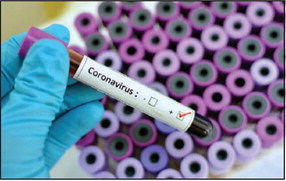 Coronavirus outbreak: What you need to know Coronavirus outbreak: What you need to know